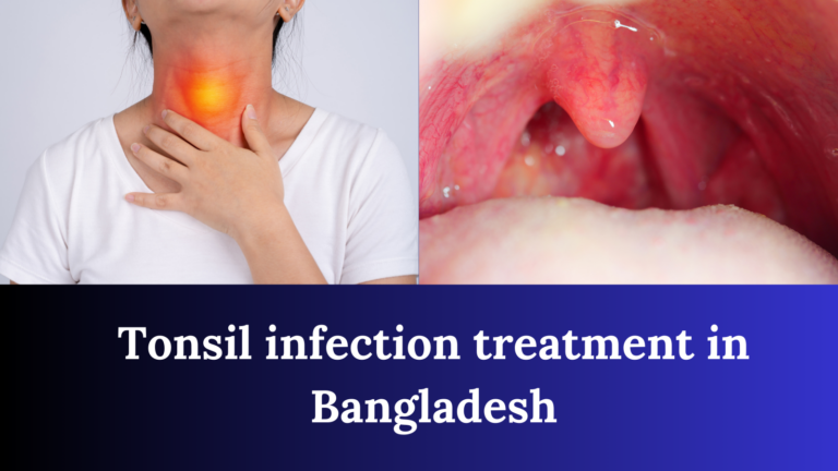Tonsil infection treatment in Bangladesh