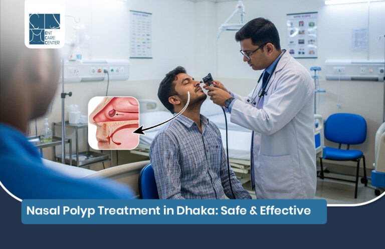 Nasal polyp treatment in Dhaka