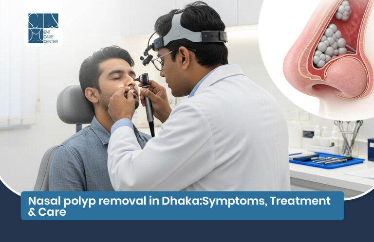 Nasal polyp removal in Dhaka