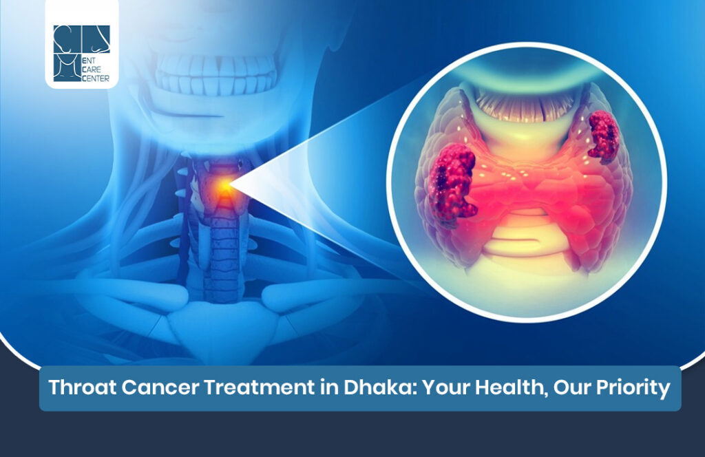 Throat cancer treatment in Dhaka