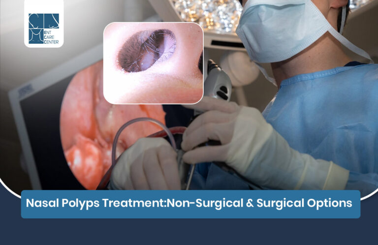 Nasal Polyps Treatment