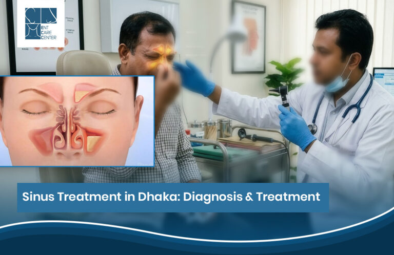 Sinus treatment in Dhaka